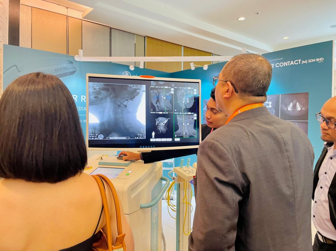 3D Mobile C-arm that provides CT-like images (MPR) in an operating theater - Ziehm Vision RFD 3D
